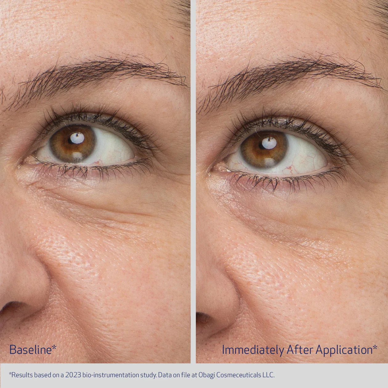 Obagi Daily Hydro-Drops - Eye Gel Cream