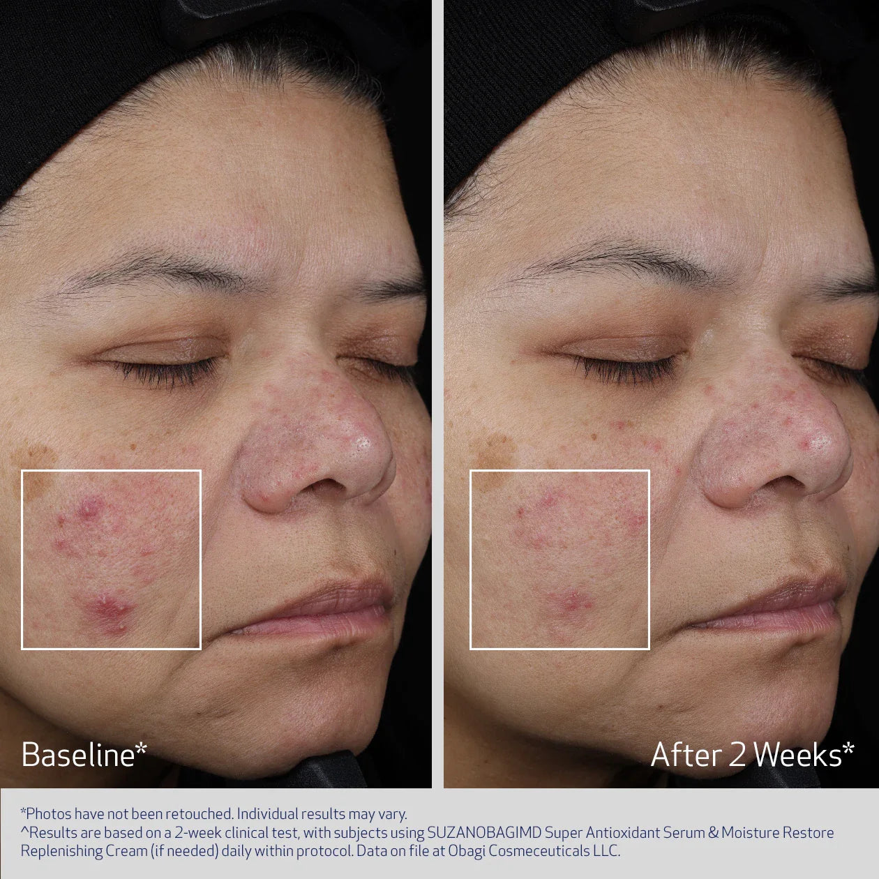 SuzanObagiMD Super Antioxidant Serum