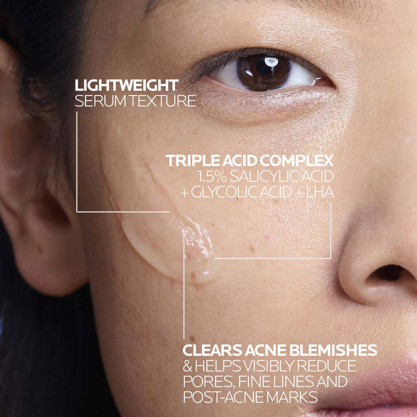 La Roche Posay Effaclar Salicylic Acid Acne Treatment